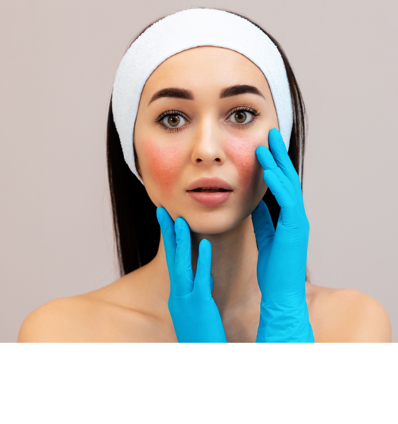 Calm Down: Skincare for Rosacea